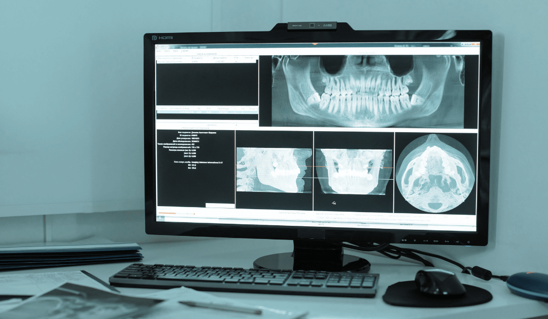When Imaging Systems Crash: Why It Happens and How to Stop Losing Chair Time