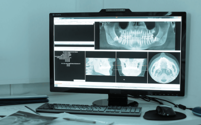 When Imaging Systems Crash: Why It Happens and How to Stop Losing Chair Time
